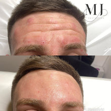 Load image into Gallery viewer, Anti Wrinkle Treatments