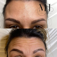 Load image into Gallery viewer, Anti Wrinkle Treatments