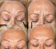 Load image into Gallery viewer, Anti Wrinkle Treatments