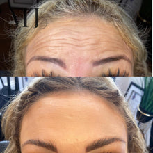 Load image into Gallery viewer, Anti Wrinkle Treatments