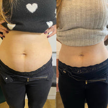 Load image into Gallery viewer, Fat Dissolving - Large Area (Stomach, Thighs, Arms)