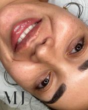 Load image into Gallery viewer, Lip Enhancement (Standard)