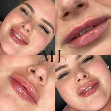 Load image into Gallery viewer, Lip Enhancement (Standard)