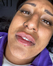 Load image into Gallery viewer, Lip Enhancement (Premium Brand)