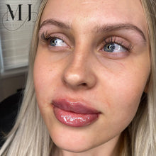 Load image into Gallery viewer, Lip Enhancement (Premium Brand)