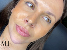 Load image into Gallery viewer, Dermal Filler Packages